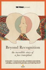 Watch Beyond Recognition: The Incredible Story of a Face Transplant Movie4k